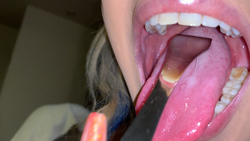 [個人]用不銹鋼舌刷wRISA④拍攝黑色舌苔