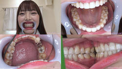 [Tooth fetish] I observed Ran-chan&#39;s teeth!