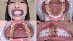 [치아 페티쉬] 허베이 하루나 짱의 치아를 관찰했습니다!