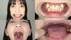 [牙齿/嘴巴]人气女演员冬之恋Kotoe-chan用鼠标开启器观察牙齿，嘴巴，嘴巴，舌头和舌头！