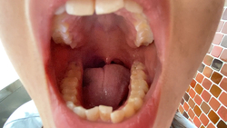 [Transcendent healthy oral cavity] Yuka KITR00290