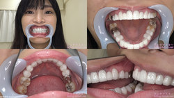 【歯フェチ】久留木玲ちゃんの歯を観察しました！