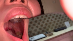 [個人攝影]閃亮的前牙閃亮的後牙暗物質色情成熟女人口腔鏡觀察靜香