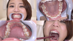[牙齒戀物癖]我觀察了三月彩的牙齒！