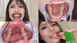 [Tooth Fetish] I observed Tsukasa Nagano&#39;s teeth!