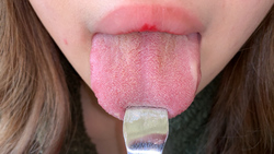 （※閲覧注意）巨根女（喉ちんこ）の乾いた舌から舌苔採取！