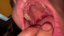 Great opening! Look at all the teeth, tongue and throat. Kotona ① KITR00279