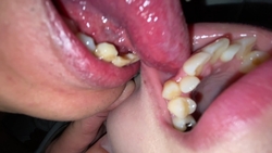 Directly lick vampire teeth Kotomi ② KITR00267