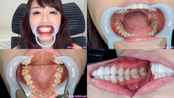 We observed the teeth [dental fetish] Hamasaki Mao-CHAN!